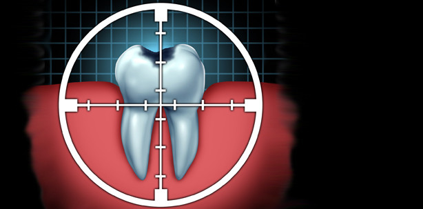 Digitale Abformung – ja oder nein?