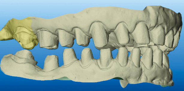 Möglichkeiten und Chancen der digitalen Zahnmedizin