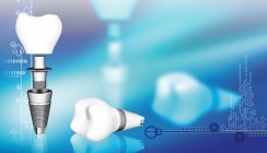 Digitalisierung in der Zahnmedizin: Universität Bern up-to-date