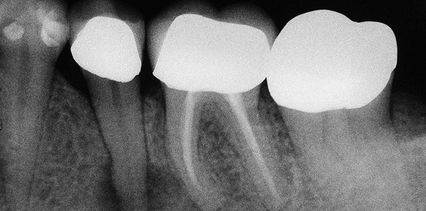 Diodenlaser: wirkungsvoll und wirtschaftlich