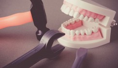 Do-it-yourself-Kieferorthopädie: Trend nimmt zu