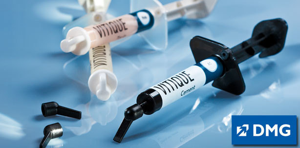 Einfache und ästhetische Veneerbefestigungen mit Vitique