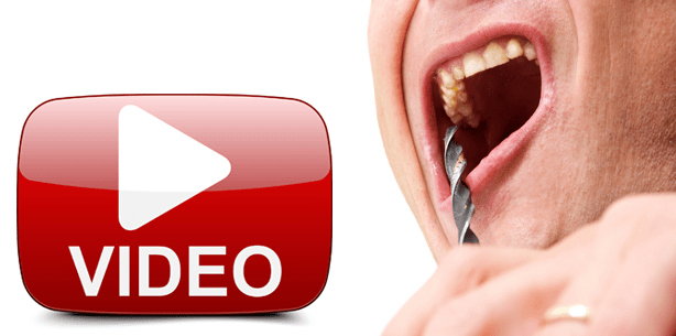 Do-it-yourself-Zahnbehandlungen bergen große Gefahren