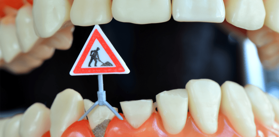 Do it yourself: Galileo testet Zahnreparatur-Set