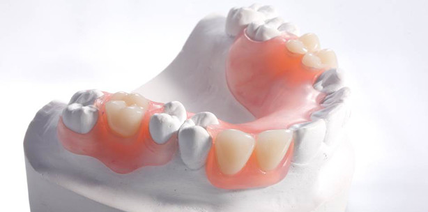 Die neue Welt der flexiblen Prothetik