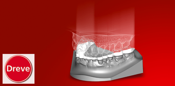 Print@Dreve: Generative Fertigung – Generative Dienstleistungen