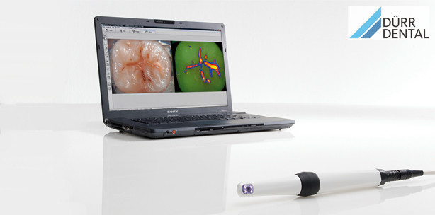 id süd: Intraoralkamera VistaCam iX