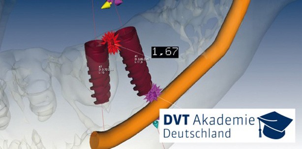 DVT Fachkunde-Kurs und Aktualisierung im Strahlenschutz