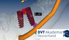 DVT Fachkunde-Kurs und Aktualisierung im Strahlenschutz