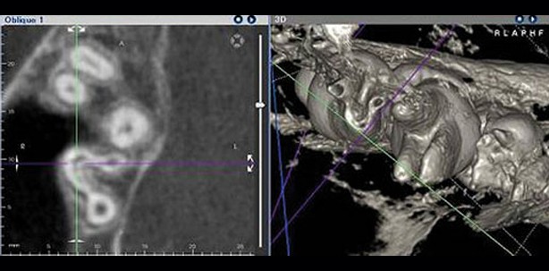 Eine neue Leitlinie zur dentalen digitalen Volumentomographie