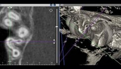 Eine neue Leitlinie zur dentalen digitalen Volumentomographie