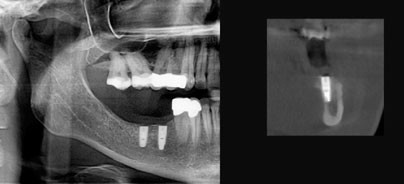Der sichere Weg in die dritte Dimension