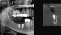 Der sichere Weg in die dritte Dimension
