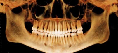 Archivieren und Versenden von DVT-Daten