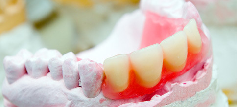 Verschrottungsprämie für Zahnersatz unsinnig