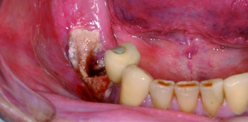 Komplexe Situationen und Komplikationen