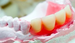 Kostenvoranschlag auch für Zahnersatz aus Ausland