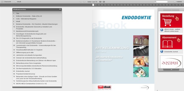 Neues eBook "Moderne Endodontie im Überblick"