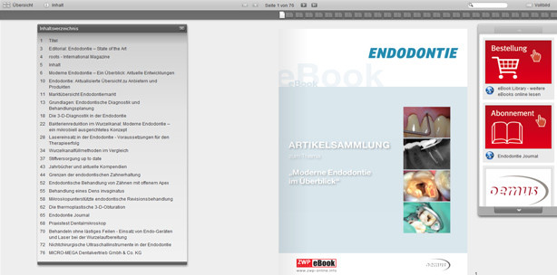 Neues eBook "Moderne Endodontie im Überblick"