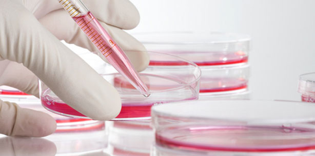 EHEC: Wissenschaftler bestimmen Genomsequenz