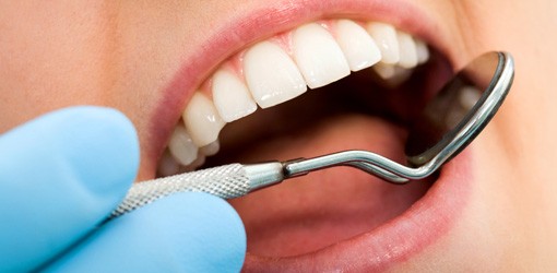 Alternativen zu Amalgam als Zahnfüllung - Teilnehmer für Studie gesucht