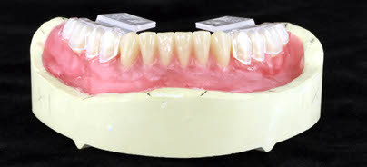 Ein Zahn für alle Fälle