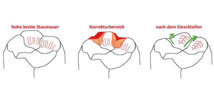 articleImage
