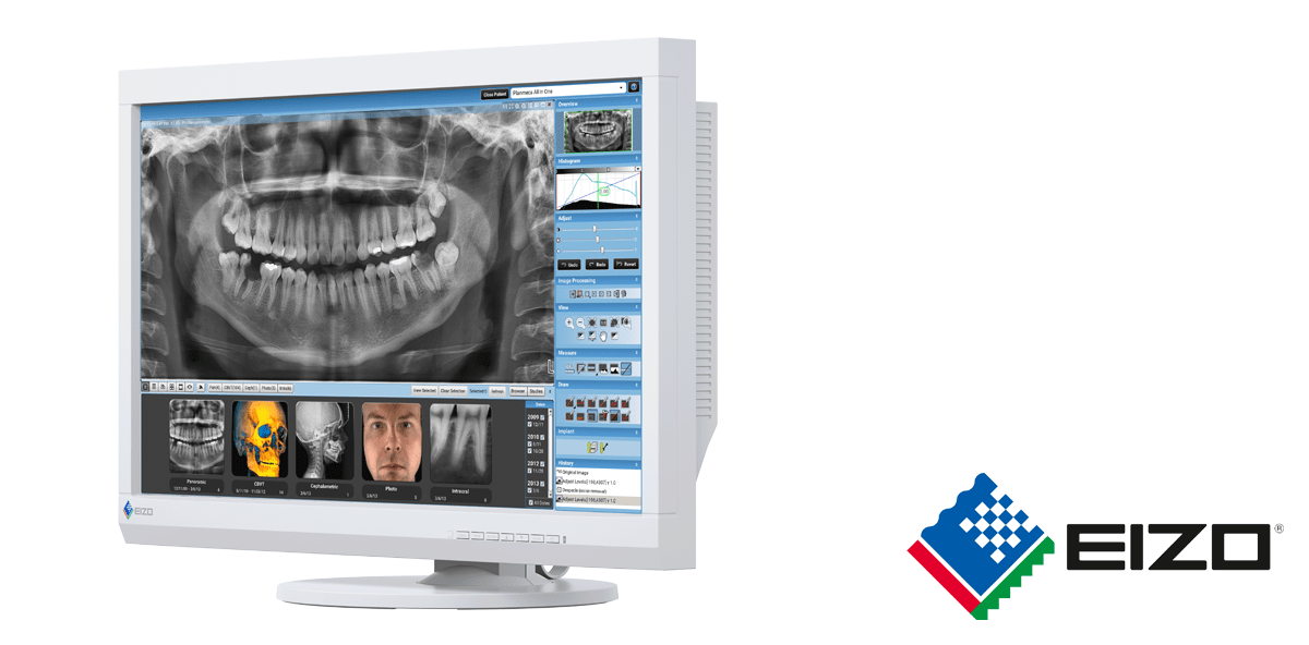 Neuer Befundungsmonitor für Dentalaufnahmen