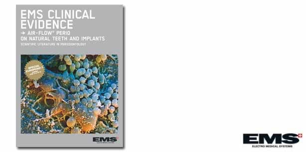 EMS Air-Flow Perio erfolgreich in klinischen Studien getestet