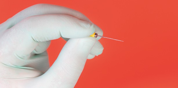 Endodontische Revisionsbehandlung wirtschaftlich abrechnen