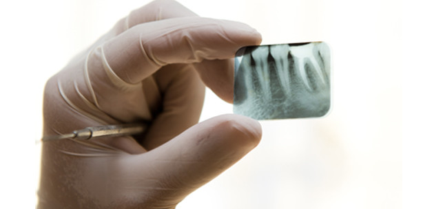 Endodontie = Zahnerhaltung?