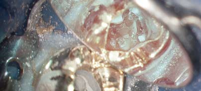 Klassische und neue Methoden in der Endodontie