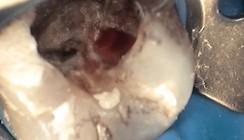 Wege aus der Überexkavation