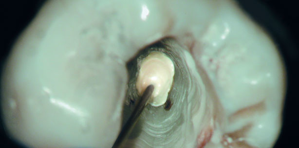 Aufbereiten – Spülen – Füllen