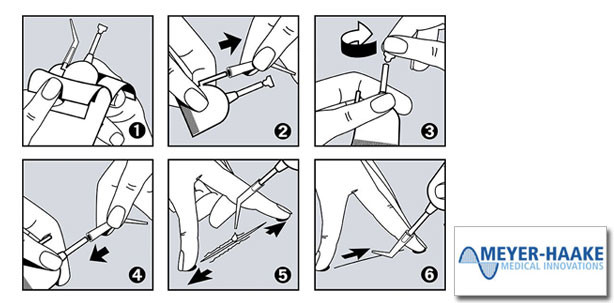 Ein Wundkleber, der auch auf der Schleimhaut haftet