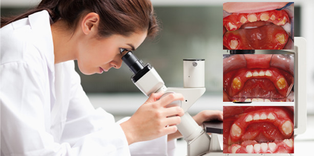 Ursache für seltene erbliche Krankheit geklärt