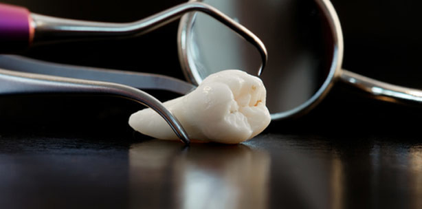 Falsche Ärztin zieht gesunden Zahn