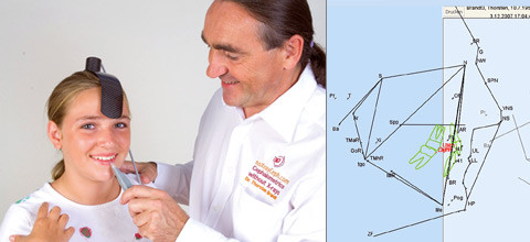 3D-Kiefervermessung ohne Röntgen