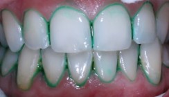 Grün – eine Farbe mit Zukunft