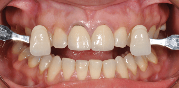 Anleitung zur Farbnahme und Kommunikation mit dem Labor