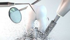 FDI legt Whitepaper zur Behandlung von Karies vor