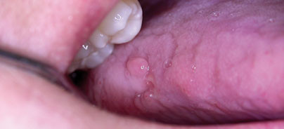 Respekt vor der Zunge?