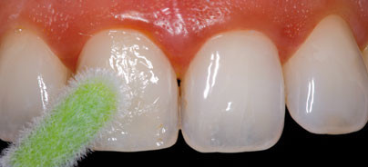 Mit Schutzlacken präventive Konzepte umsetzen