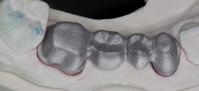 Lasersintern im digitalen Workflow