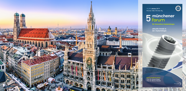 Aktuelle Trends der Implantologie in München
