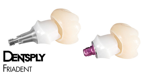 DENTSPLY Friadent bietet Lösungskonzepte „von der Wurzel bis zur Krone“
