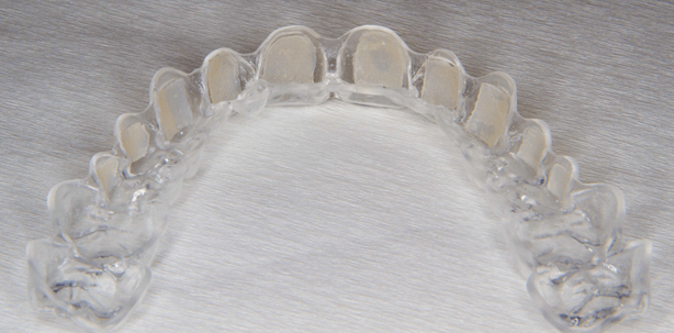 Friction Pads – Klinische Handhabung