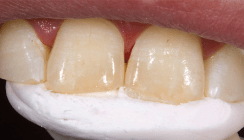 Vollkommene Ästhetik mit geringem Aufwand