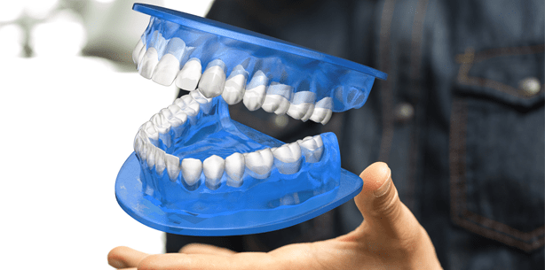 Studie: Zahnärzte verpassen Patienten in Städten öfter Kronen