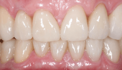 Funktion ist nicht alles, aber ohne Funktion ist alles nichts